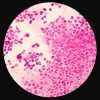 infections-nosocomiales-evitees-bluetoo-L-1 infections-nosocomiales-evitees-bluetoo-L-1